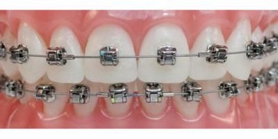 Orthodontics