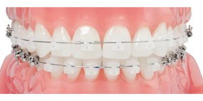 cosmetic-dentistry