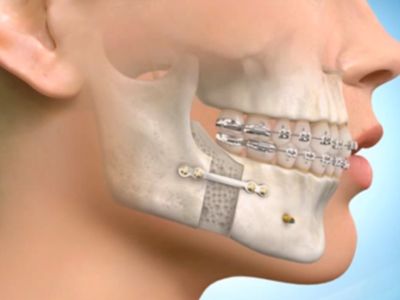 Orthodontics