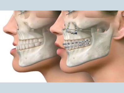 cosmetic-dentistry