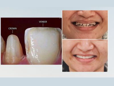 cosmetic-dentistry